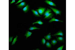 Immunofluorescence staining of Hela cells with ABIN7143995 at 1:66, counter-stained with DAPI.