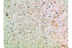 Immunohistochemical analysis of paraffin-embedded Human-brain, antibody was diluted at 1:100 (ASIC1 antibody  (AA 220-280))