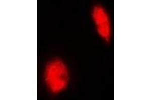 Immunofluorescent analysis of ERG staining in Hela cells. (ERG antibody)