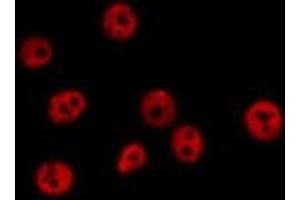 ABIN6278396 staining  Hela cells by IF/ICC. (RASSF2 antibody  (Internal Region))