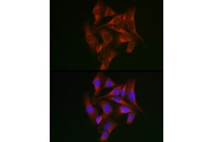 Immunofluorescence analysis of U2OS cells using STA Rabbit pAb (ABIN6128540, ABIN6148576, ABIN6148578 and ABIN6223670) at dilution of 1:50 (40x lens). (STAT5A antibody  (AA 635-794))