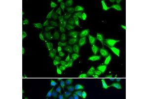 Immunofluorescence analysis of MCF-7 cells using MID1 Polyclonal Antibody
