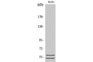 Western Blotting (WB) image for anti-serpin Peptidase Inhibitor, Clade A (Alpha-1 Antiproteinase, Antitrypsin), Member 6 (SERPINA6) (Internal Region) antibody (ABIN3183700) (SERPINA6 antibody  (Internal Region))