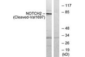 Western blot analysis of extracts from Jurkat cells, treated with etoposide 25uM 24h, using NOTCH2 (Cleaved-Val1697) Antibody. (NOTCH2 antibody  (Cleaved-Val1697))