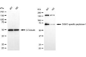 Western blotting analysis using SUMO specific peptidase 1 antibody (ABIN7800975).