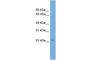 WB Suggested Anti-COPS8  Antibody Titration: 0. (COPS8 antibody  (Middle Region))