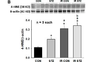 The diabetes effect on IR affected cardiac lipid peroxidation in MDA content (A, n = 6), 4-HNE expression (B, n = 3), leukocyte infiltration and cardiac structure (C,D, n = 5), microcirculation (E,F, n = 10) and infarct size (G,H, n = 5) in IR CON and IR STZ rats.