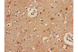 Immunohistochemistry of paraffin-embedded human brain tissue using ABIN7170921 at dilution of 1:100