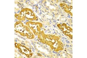 Immunohistochemistry (IHC) image for anti-Bridging Integrator 1 (BIN1) (AA 230-409) antibody (ABIN1678863)