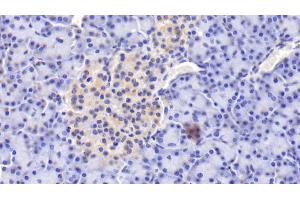 Detection of PIIINP in Human Pancreas Tissue using Polyclonal Antibody to Procollagen III N-Terminal Propeptide (PIIINP) (PIIINP antibody)