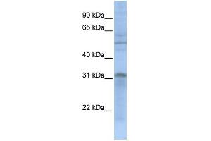 WB Suggested Anti-MTCH2 Antibody Titration: 0. (MTCH2 antibody  (N-Term))