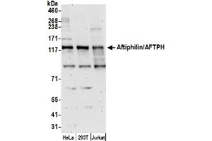 anti-Aftiphilin (AFTPH) (AA 575-625) antibody
