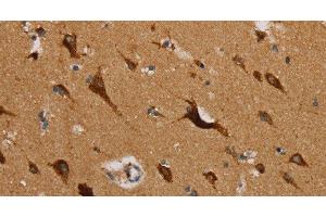 Immunohistochemistry of paraffin-embedded Human brain using MRPL39 Polyclonal Antibody at dilution of 1:45 (MRPL39 antibody)