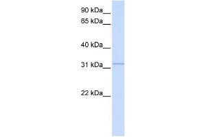 SUSD4 antibody used at 1 ug/ml to detect target protein. (SUSD4 antibody  (N-Term))