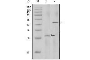 Western Blot showing IL2 antibody used against full-length IL2 recombinant protein with Trx tag (1) and full-length IL2-hIgGFc transfected HEK293 cell lysate (2). (IL-2 antibody)