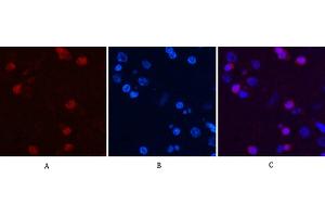 Immunofluorescence analysis of rat brain tissue. (Peroxiredoxin 1 antibody)