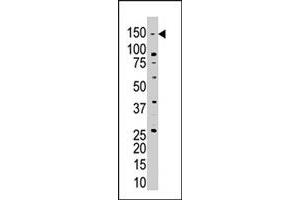 The USP28 polyclonal antibody  is used in Western blot to detect USP28 in Jurkat cell lysate .