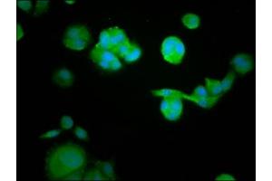 Immunofluorescence staining of MCF-7 cells with ABIN7167413 at 1:105, counter-stained with DAPI. (RASAL1 antibody  (AA 698-804))