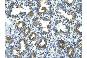 Rabbit Anti-GUSB Antibody       Paraffin Embedded Tissue:  Human alveolar cell   Cellular Data:  Epithelial cells of renal tubule  Antibody Concentration:   4. (Glucuronidase beta antibody  (C-Term))