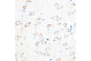 Immunohistochemistry of paraffin-embedded rat brain using TCTP/TPT1 Rabbit mAb (ABIN7271101) at dilution of 1:100 (40x lens). (TPT1 antibody)