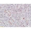 anti-Insulin-Like Growth Factor 1 Receptor (IGF1R) (AA 251-350) antibody