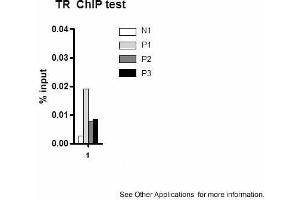 Application: ChIPSample Type: mouse liver tissueChromatin Used: 100ug tissueAntibody Used: 10ug  Image Submitted by: Joanna DiSpiritoUniversity of Pennsylvania (THRB antibody  (N-Term))