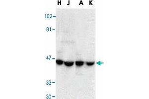 Western blot analysis of DFFA in HeLa (H), Jurkat (J), A-431 (A), and K-562 (K) whole cell lysate with DFFA polyclonal antibody  at 1 : 1000 dilution. (DFFA antibody  (AA 313-331))