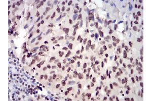 Immunohistochemistry (IHC) image for anti-Janus Kinase 2 (JAK2) (AA 745-955) antibody (ABIN5542629)