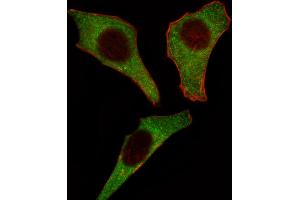 Fluorescent image of Hela cell stained with CDK4 Antibody . (CDK4 antibody  (C-Term))