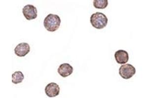 Immunohistochemistry (Frozen Sections) (IHC (fro)) image for anti-Chemokine (C-X-C Motif) Receptor 4 (CXCR4) (Isoform A), (N-Term) antibody (ABIN499700)
