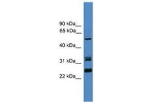 Image no. 1 for anti-Leucine Rich Repeat (In FLII) Interacting Protein 2 (LRRFIP2) (AA 51-100) antibody (ABIN6745323) (LRRFIP2 antibody  (AA 51-100))