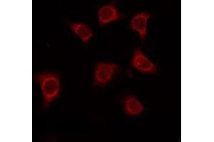 ABIN6275034 staining Hela by IF/ICC. (CD55 antibody  (Internal Region))