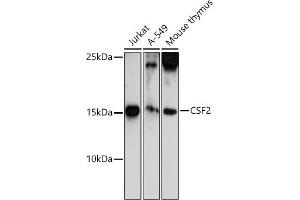 Western blot analysis of extracts of various cell lines, using CSF2 antibody (ABIN6130426, ABIN6139094, ABIN6139095 and ABIN6221725) at 1:500 dilution. (GM-CSF antibody  (AA 18-144))