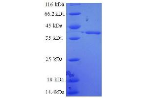 Enhancer of Rudimentary Homolog (Drosophila) (ERH) (AA 2-104), (full length) protein (GST tag)