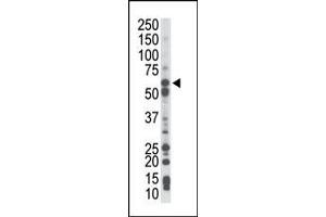 The anti-PCK1 Pab (ABIN392676 and ABIN2842169) is used in Western blot to detect PCK1 in mouse liver tissue lysate. (PCK1 antibody  (N-Term))