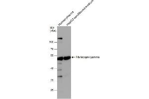 WB Image Fibrinogen gamma antibody detects Fibrinogen gamma protein by western blot analysis. (FGG antibody)