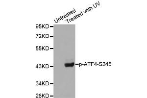 Western Blotting (WB) image for anti-Activating Transcription Factor 4 (Tax-Responsive Enhancer Element B67) (ATF4) (pSer245) antibody (ABIN1869995) (ATF4 antibody  (pSer245))