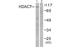 Western blot analysis of extracts from HuvEc cells, using HDAC7 antibody (ABIN5976424).