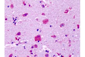 Anti-GPR83 antibody IHC of human brain, cortex, neurons. (GPR83 antibody  (Extracellular Domain))