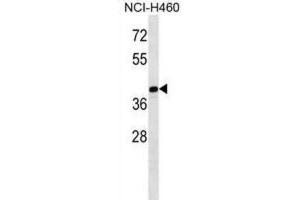 Western Blotting (WB) image for anti-Melanoma Antigen Family B, 10 (MAGEB10) antibody (ABIN2998596)