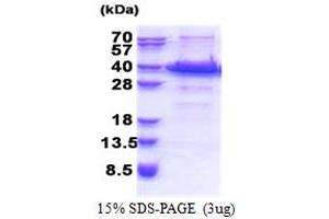 SDS-PAGE (SDS) image for Insulin-Like Growth Factor Binding Protein 7 (IGFBP7) (AA 27-282) protein (His tag) (ABIN6387352)