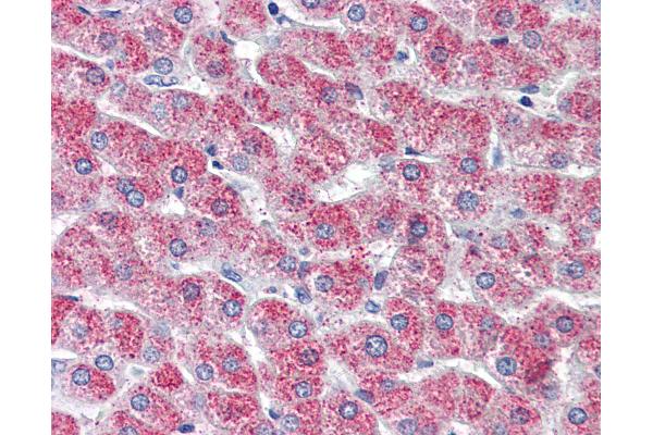 G Protein-Coupled Receptor 126 antibody  (N-Term)