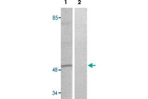 Western blot analysis of Lane 1: heat shock treated HT-29 cells, Lane 2: antigen-specific peptide treated HT-29 cells with DPYSL2 (phospho T509) polyclonal antibody  at 1:500-1000 dilution.