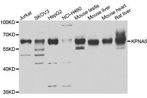 Western blot analysis of extracts of various cell lines, using KPNA5 antibody.