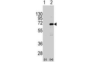 Western blot analysis of CNOT4 (arrow) using rabbit CNOT4 polyclonal antibody . (CNOT4 antibody  (N-Term))