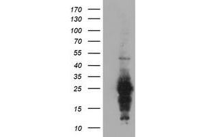 HEK293T cells were transfected with the pCMV6-ENTRY control (Left lane) or pCMV6-ENTRY RGS16 (Right lane) cDNA for 48 hrs and lysed. (RGS16 antibody)