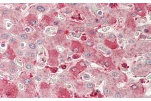Detection of NRP1 in Human Liver Tissue using Polyclonal Antibody to Neuropilin 1 (NRP1) (Neuropilin 1 antibody  (AA 646-814))