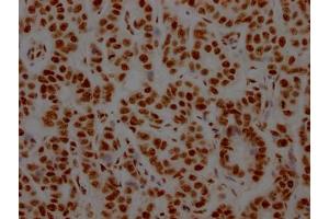 Immunohistochemistry (IHC) image for anti-Non-POU Domain Containing, Octamer-Binding (NONO) antibody (ABIN7127643)