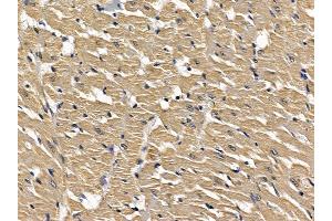 ABIN6257613 and ABIN6274480 at 1/100 staining rat heart tissue by IHC-P. (LMTK3 antibody  (Internal Region))