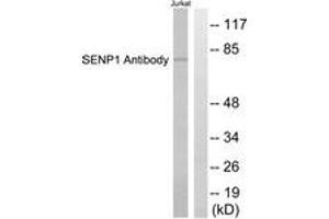 Western blot analysis of extracts from Jurkat cells, using SENP1 Antibody. (SENP1 antibody  (AA 1-50))